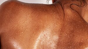 2026 Retinol Alternatives: Bakuchiol Serums for Sensitive Skin (Derm-Rated)