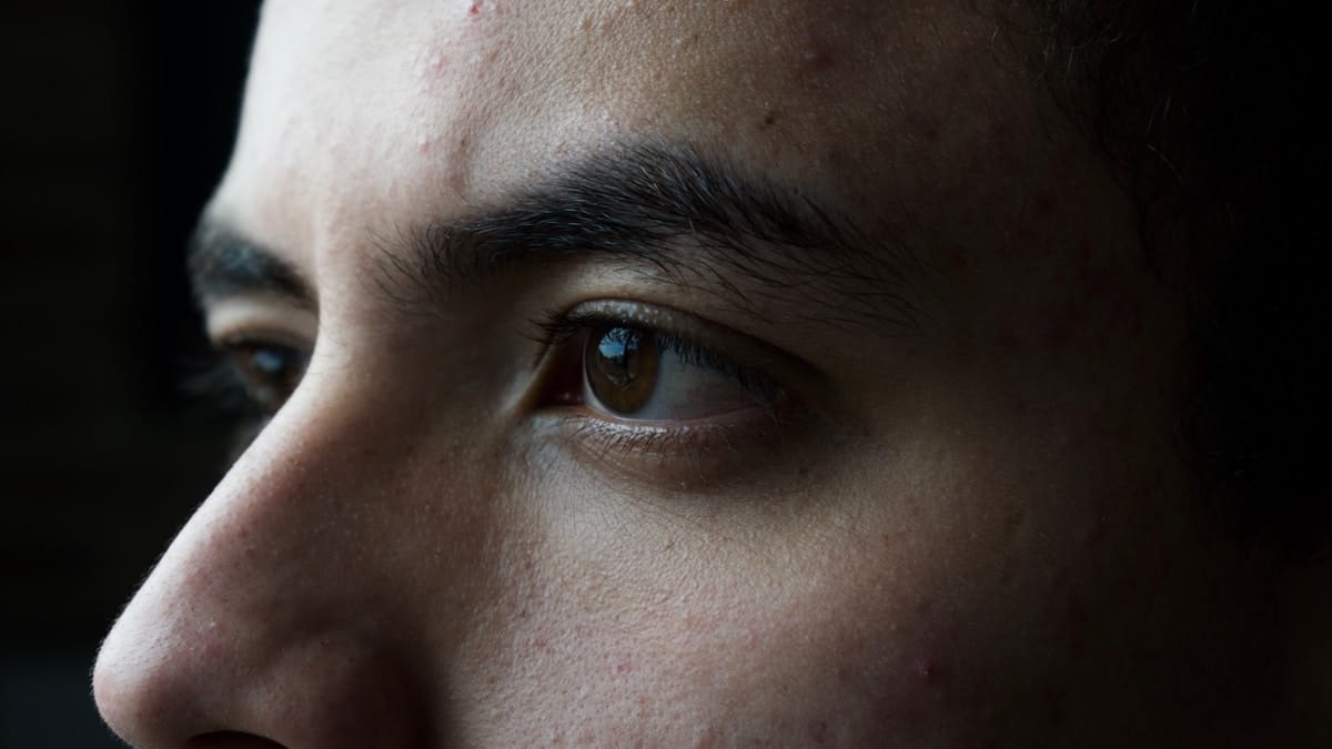 glass skin