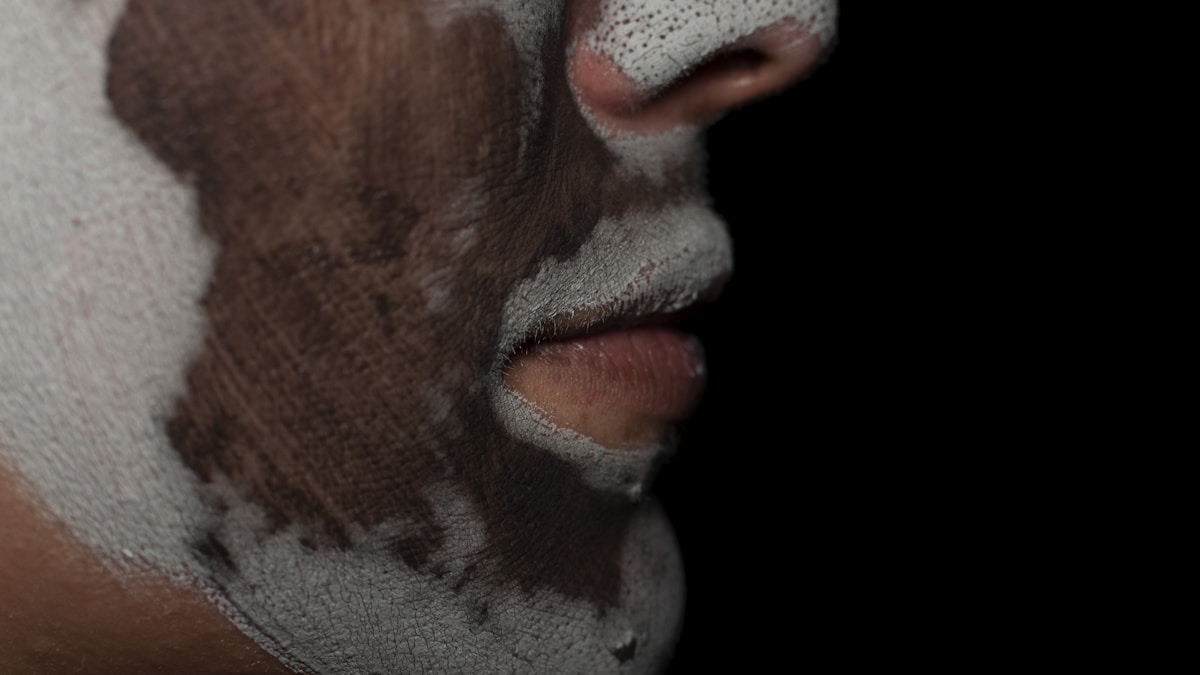 adult acne treatments