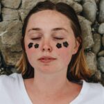 Best Acne Patches for Overnight Healing: 2026 Guide