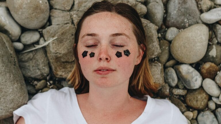 Best Acne Patches for Overnight Healing: 2026 Guide