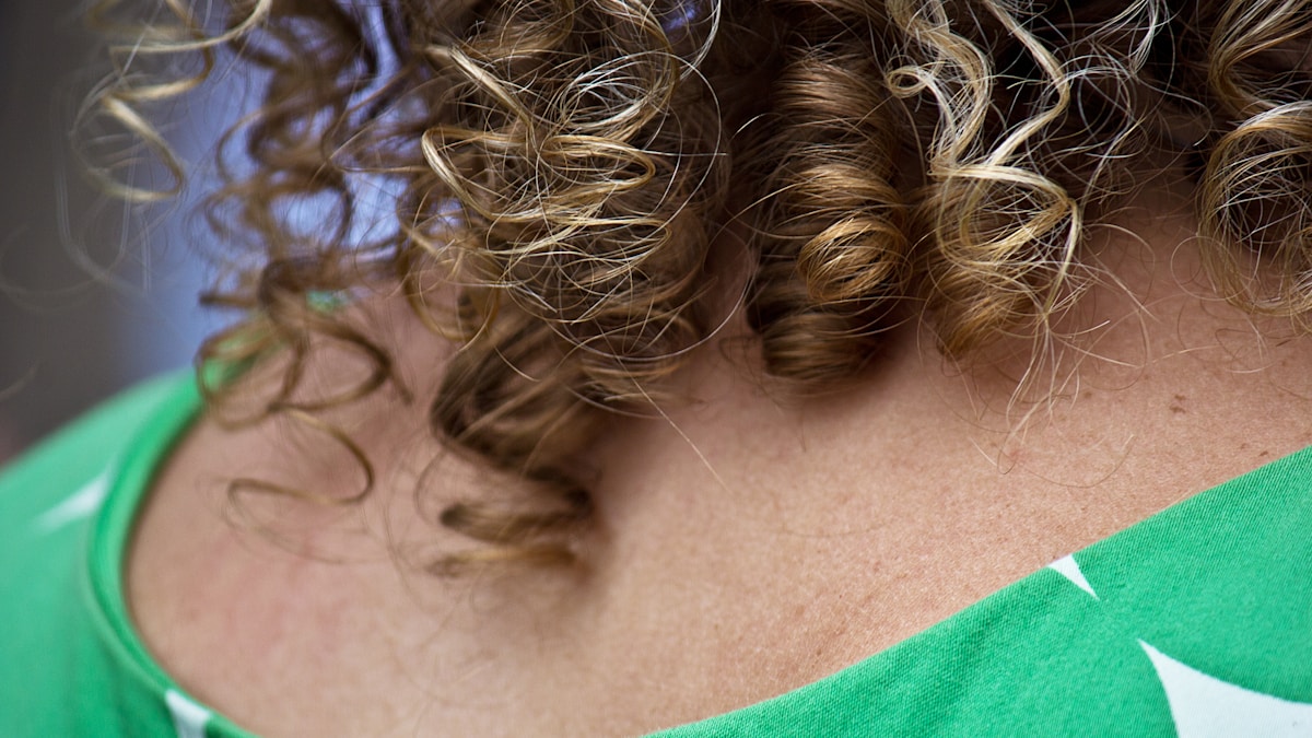 best scalp serums for thinning hair