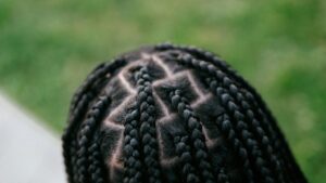 Best Scalp Sunscreens 2026: Protect Your Hair Part from UV