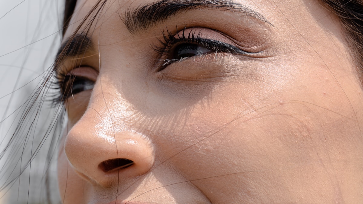 acne sunscreen