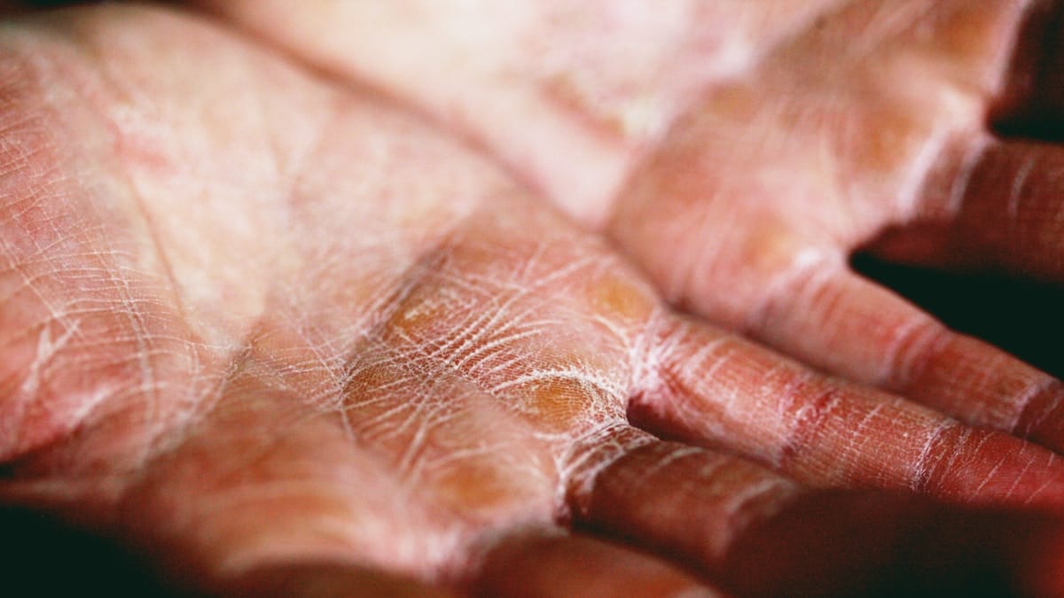 glass skin 95 - glass skin