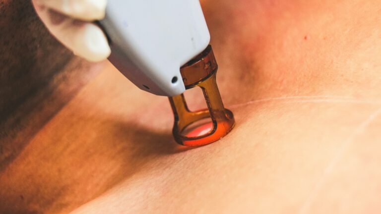 Laser vs Microneedling: Best Anti-Aging Treatments 2026