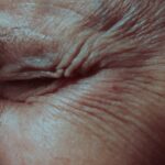Laser vs Skincare for Wrinkles: Which Wins in 2026?