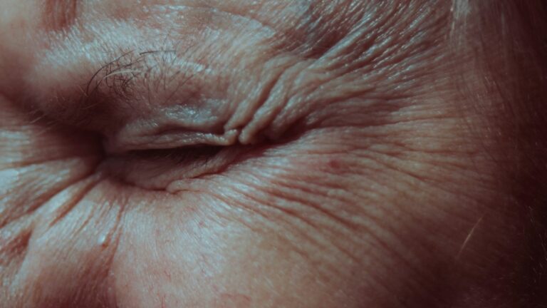Laser vs Skincare for Wrinkles: Which Wins in 2026?