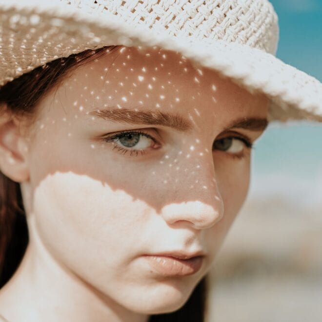melasma sunscreen – Derm-Recommended Sunscreens for Melasma: US Dermatologists