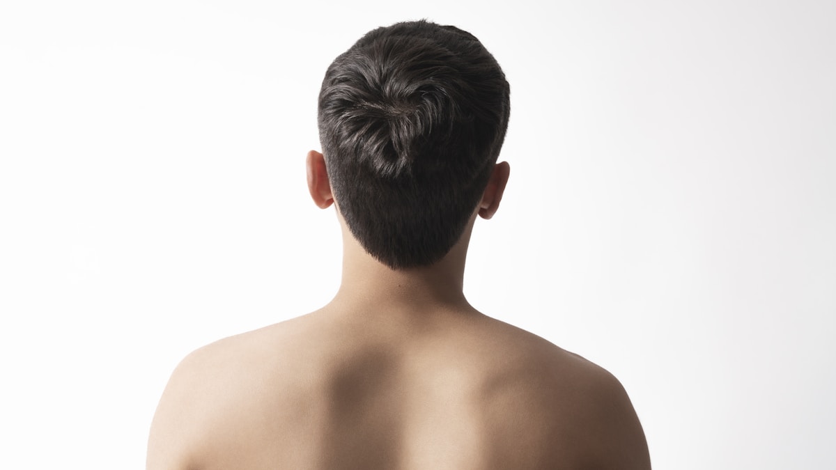 PRP hair restoration cost