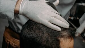 PRP Hair Restoration Cost: Top US Cities 2026