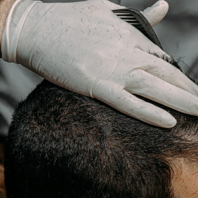 PRP Hair Restoration Cost: Top US Cities 2026