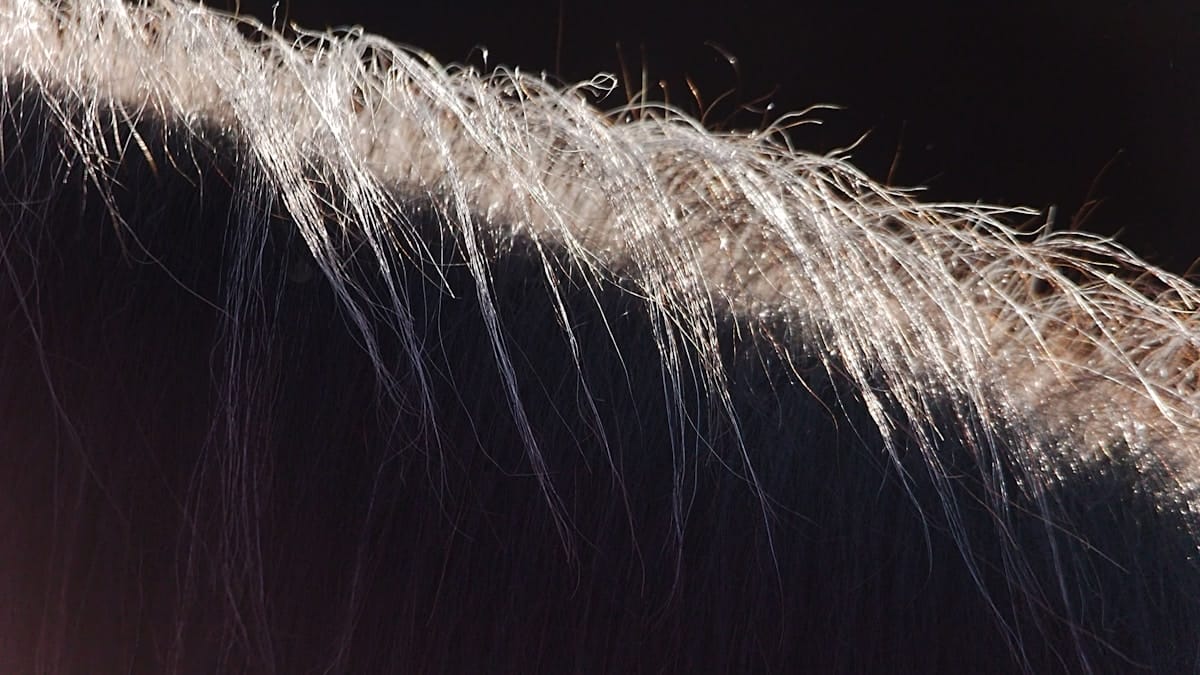 scalp sunscreen 2026 - scalp sunscreen