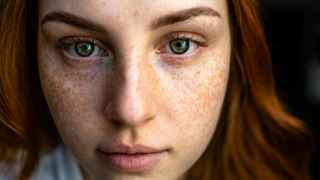 Spironolactone vs Salicylic Acid: New Acne Treatments 2026