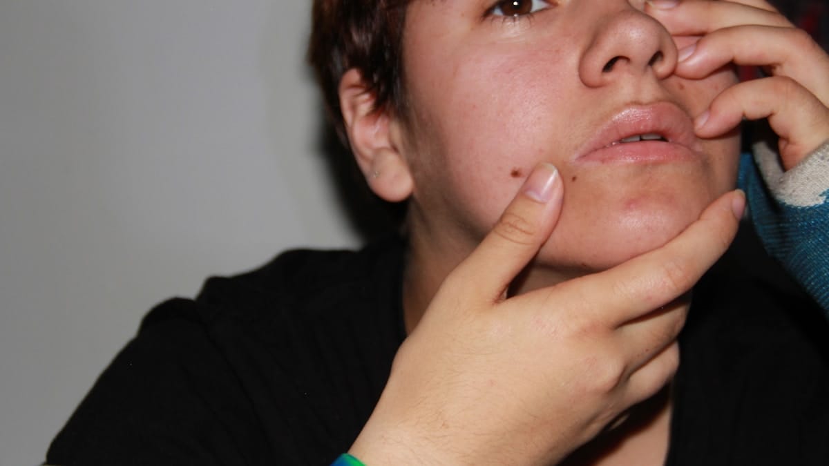 retinol alternatives sensitive skin