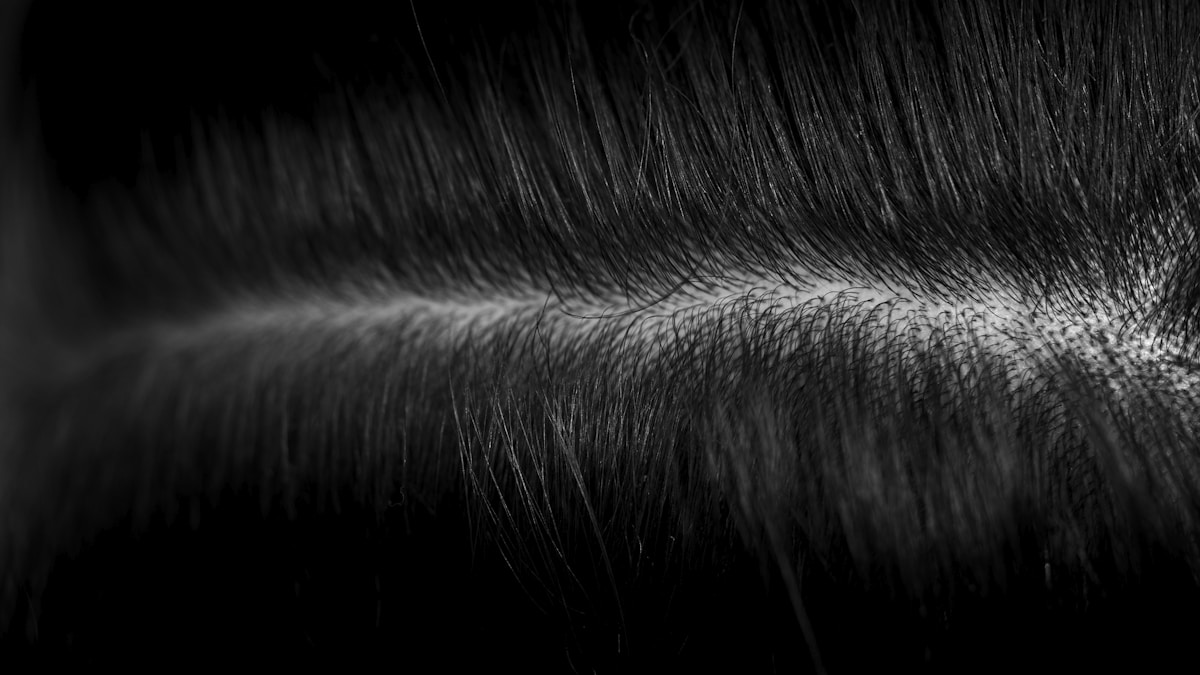 topical finasteride