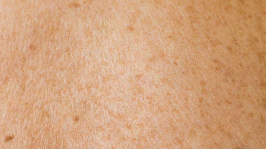 Why Bakuchiol Is Better Than Retinol for Sensitive Skin 2026