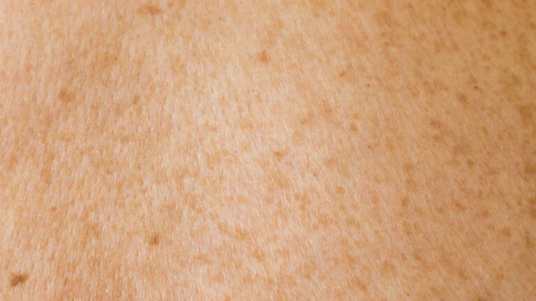 Why Bakuchiol Is Better Than Retinol for Sensitive Skin 2026