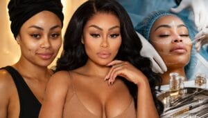 blac chyna cosmetic surgery – Blac Chyna’s Full Cosmetic Surgery Journey: Before and After